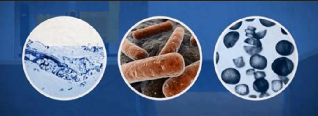 Alghe e batteri del serbatoio della barca visti al microscopio